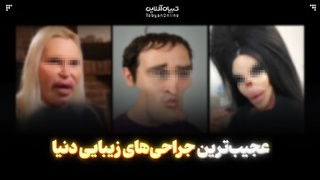 عجیب‌ترین جراحی‌های زیبایی دنیا