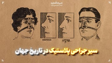 سیر جراحی‌ پلاستیک در تاریخ جهان