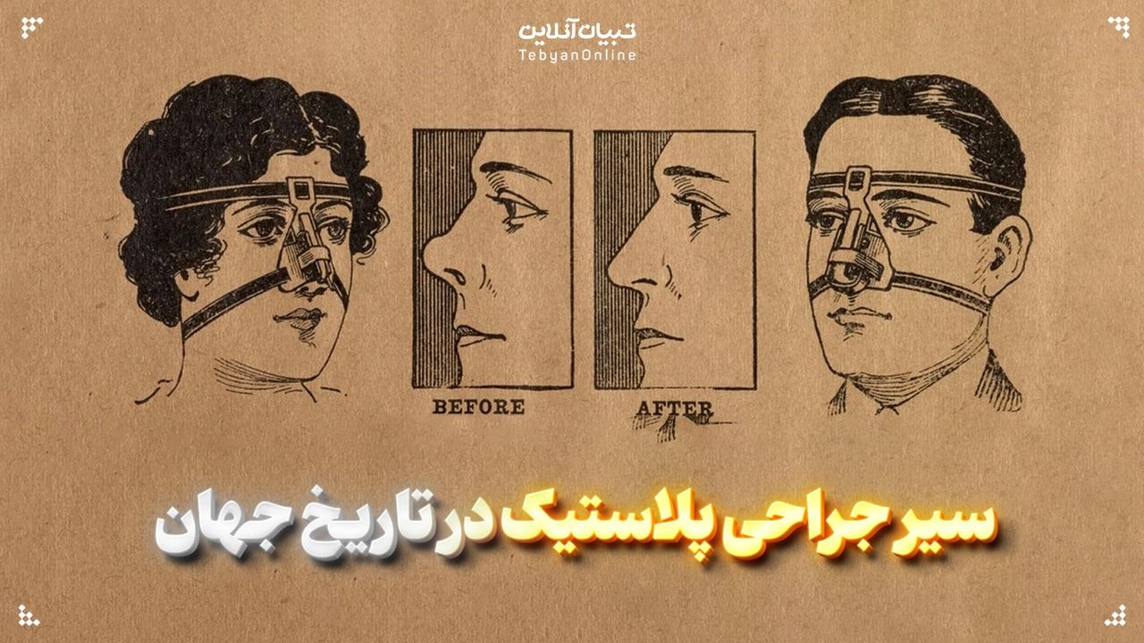 سیر جراحی‌ پلاستیک در تاریخ جهان