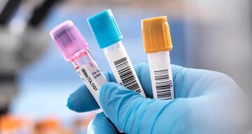 علت‌های پایین‌بودن هموگلوبین در مردان