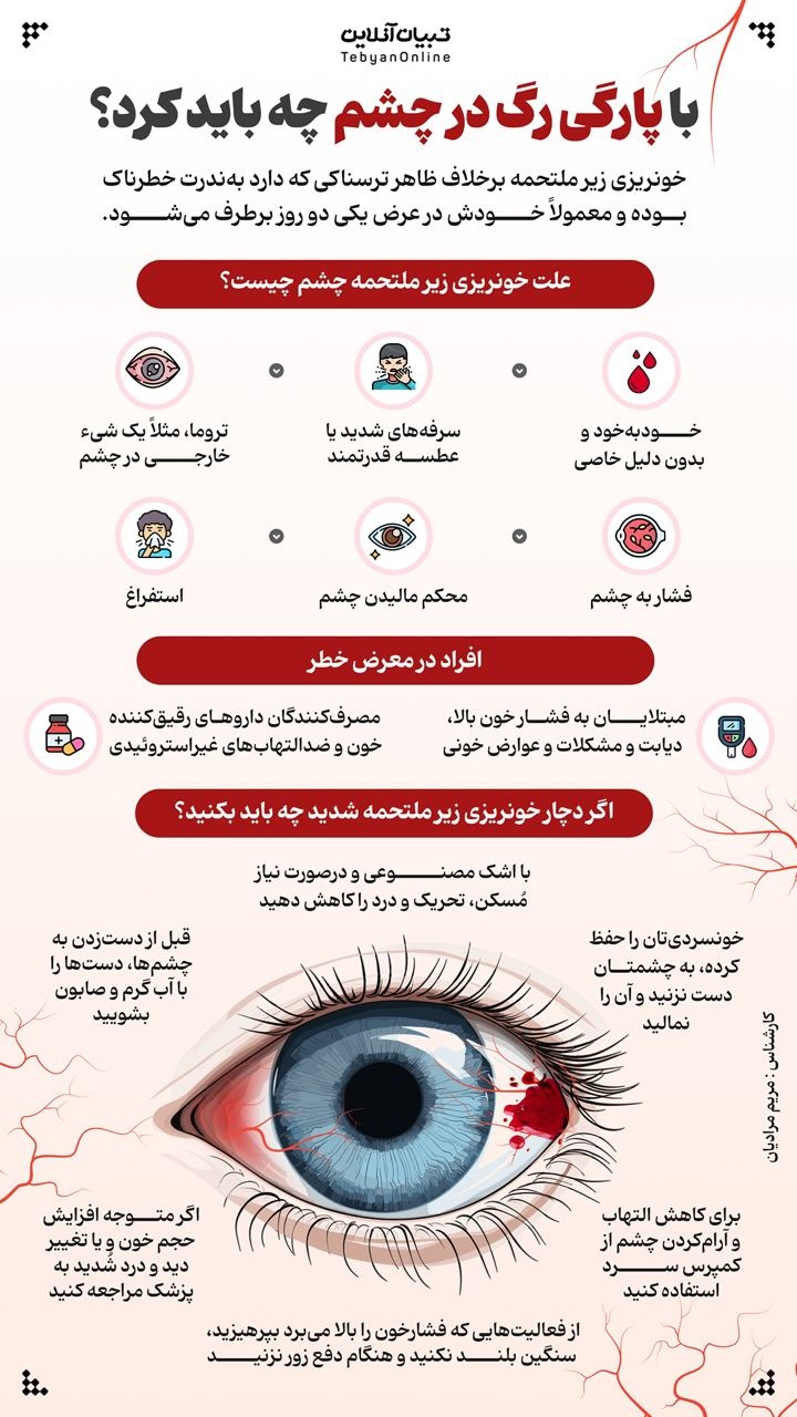 با پارگی رگ در چشم چه باید کرد؟