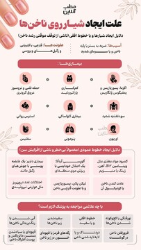 علت ایجاد شیار روی ناخن‌ها