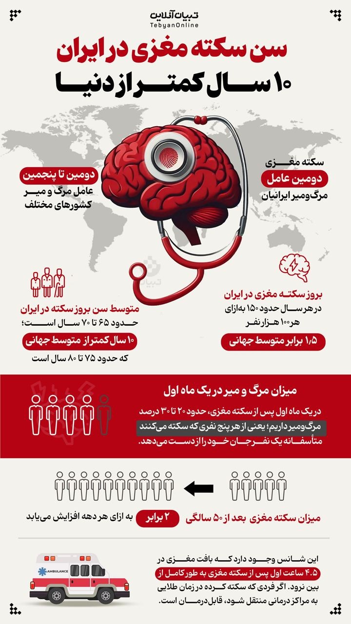 سن سکته مغزی در ایران ۱۰ سال کمتر از دنیا