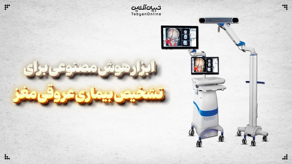 ابزار هوش مصنوعی برای تشخیص بیماری عروقی مغز ابزار هوش مصنوعی برای تشخیص بیماری عروقی مغز
