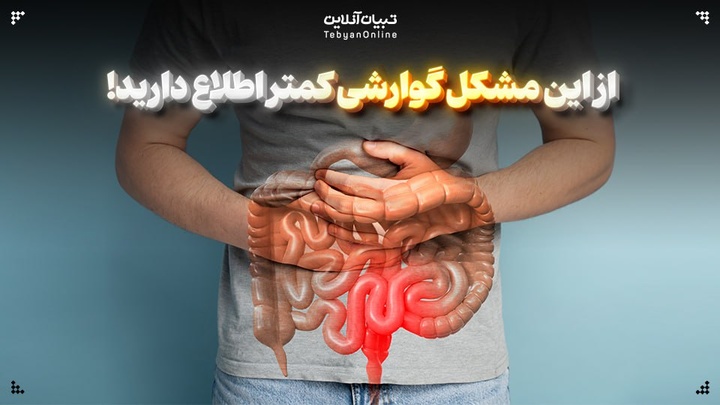 مخاط در مدفوع؛ مشکل گوارشی که کمتر راجع به آن صحبت می‌شود