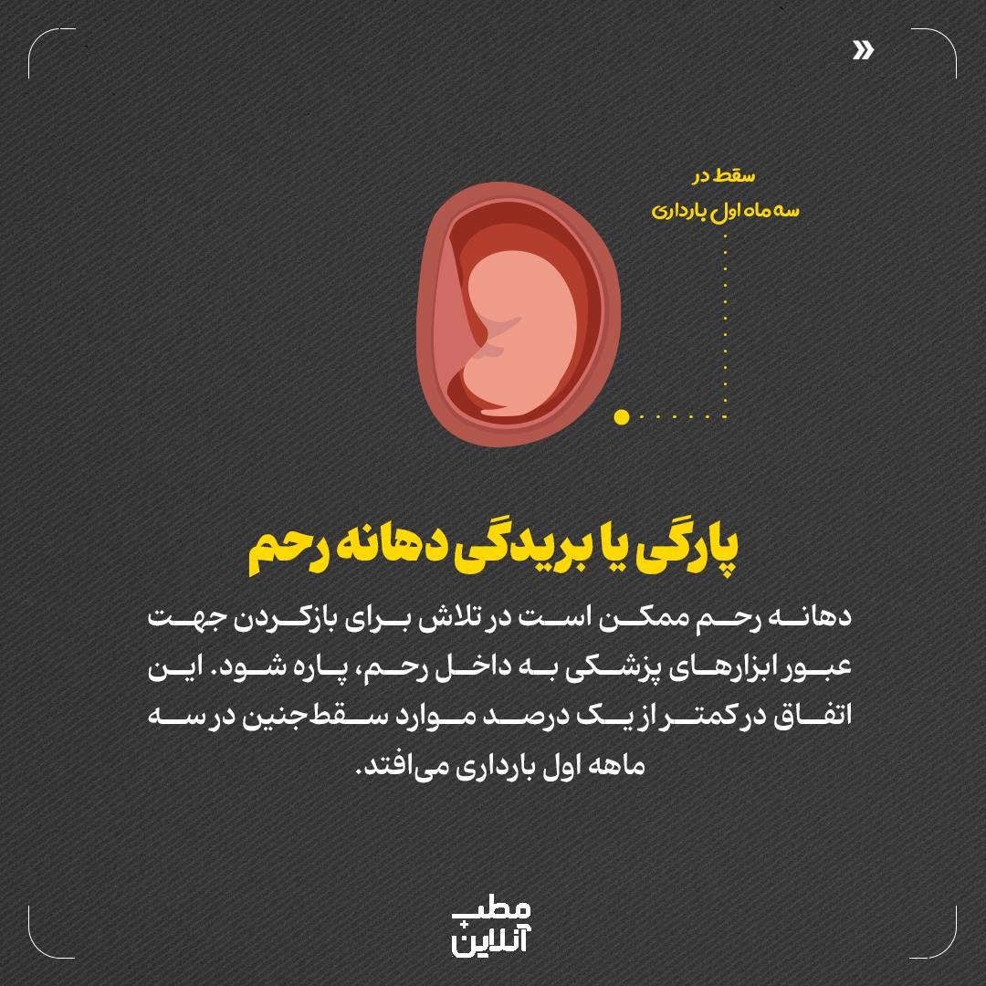 سقطجنین؛ از عوارض جسمی تا مشکلات روحی روانی