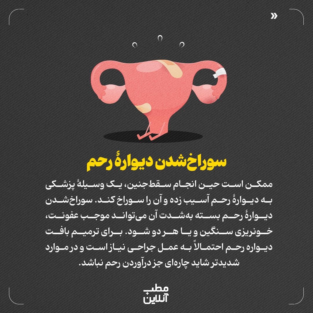 سقطجنین؛ از عوارض جسمی تا مشکلات روحی روانی