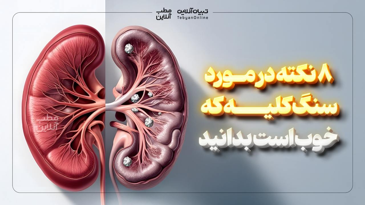 ۸ نکته در مورد سنگ کلیه که خوب است بدانید