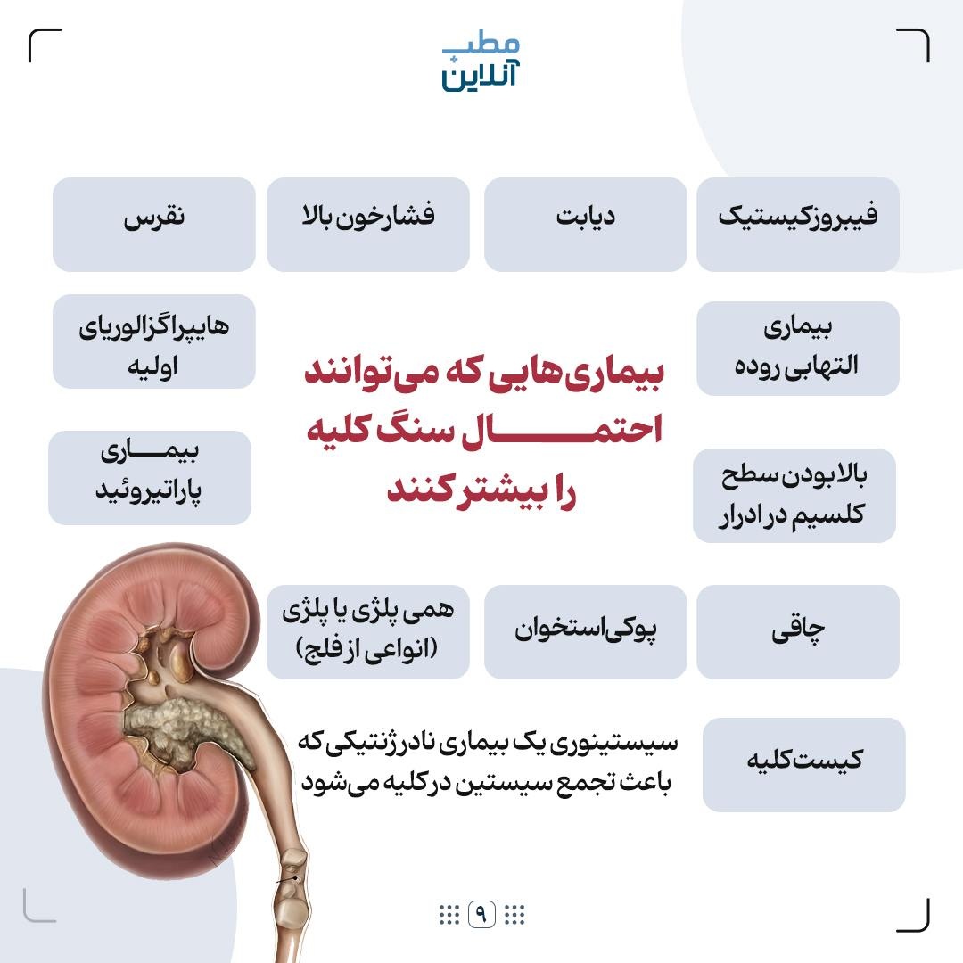 ۸ نکته در مورد سنگ کلیه که خوب است بدانید