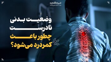 چگونه وضعیت بدنی نادرست موجب کمردرد می‌شود؟