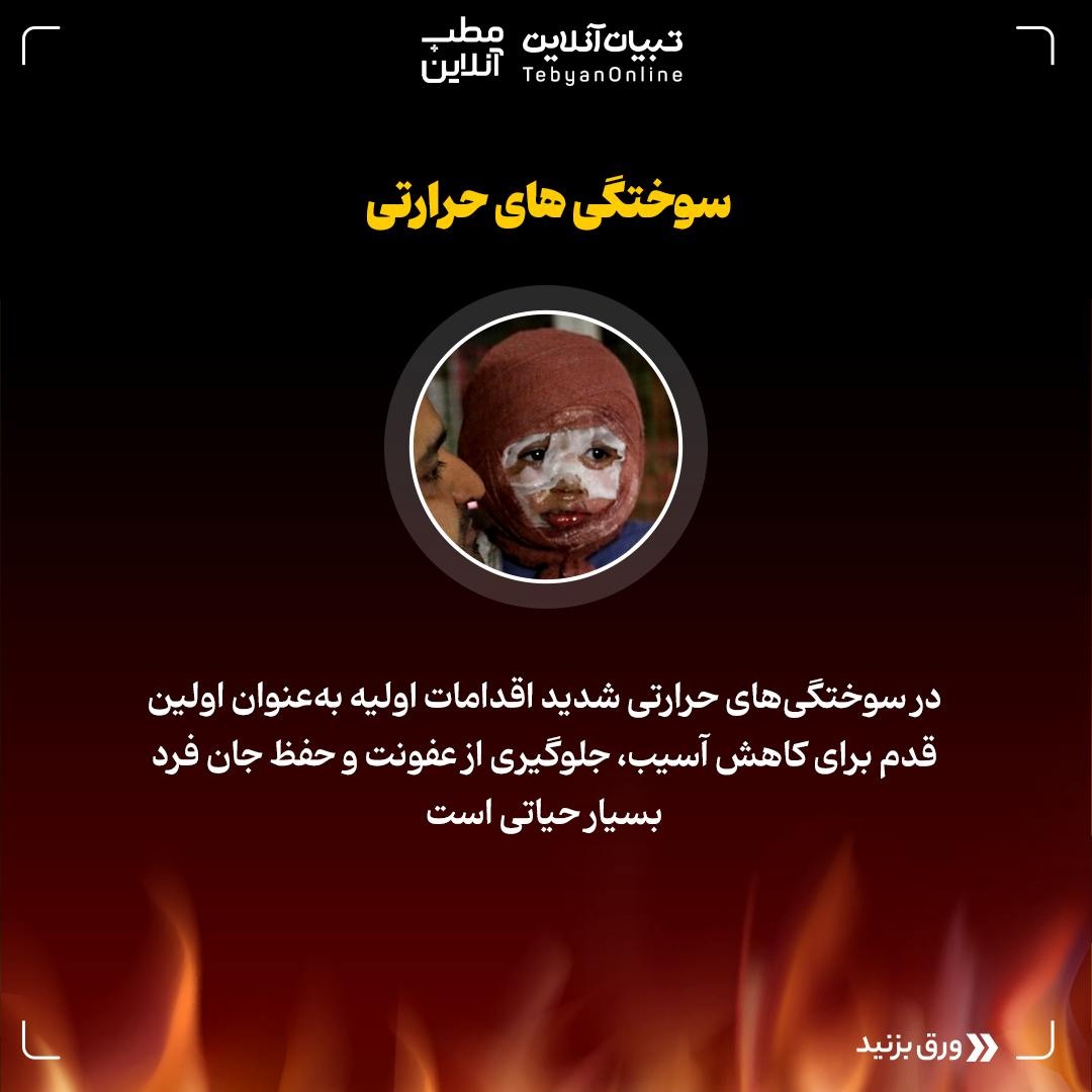 اقدامات اولیه در مواجهه با سوختگیهای ناشی از آتش و مواد محترقه