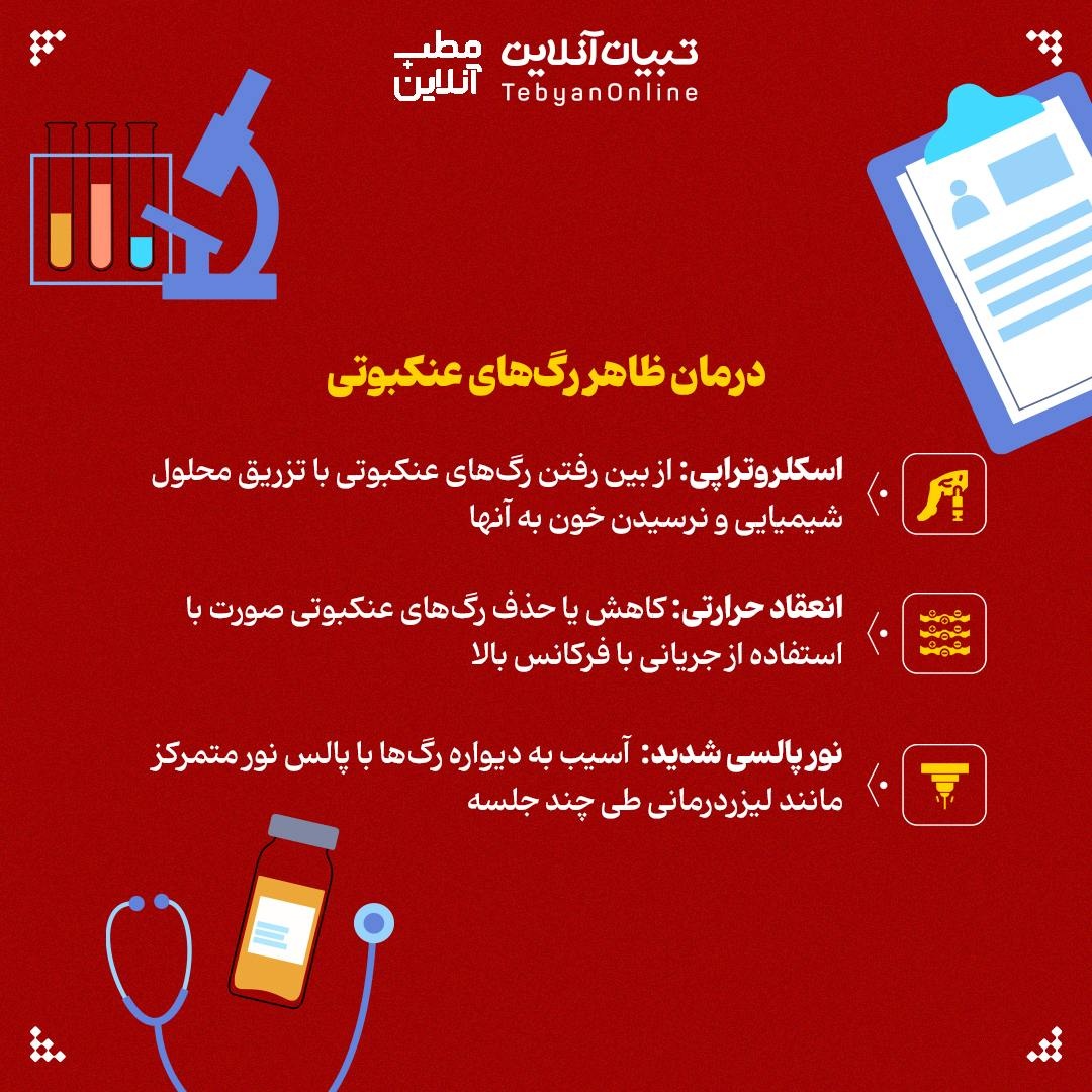 چگونه از رگهای عنکبوتی پیشگیری کنیم؟