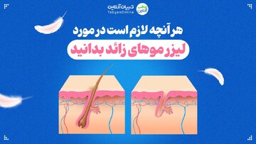هر آنچه لازم است در مورد لیزر موهای زائد بدانید