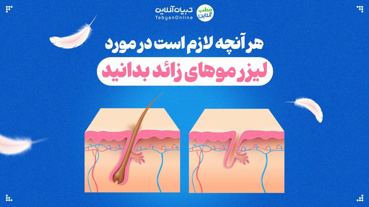 هر آنچه لازم است در مورد لیزر موهای زائد بدانید
