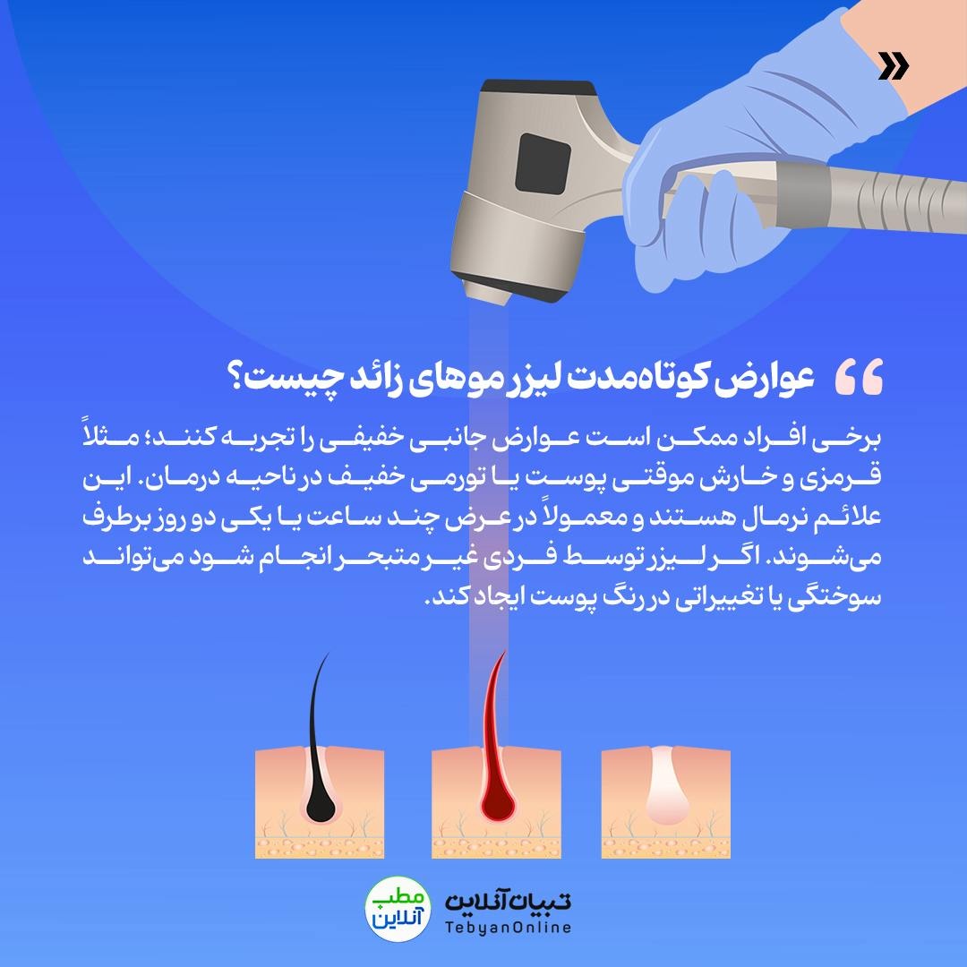 هر آنچه لازم است در مورد لیزر موهای زائد بدانید