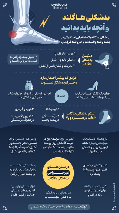 بدشکلی هاگلند و آنچه باید از آن بدانید