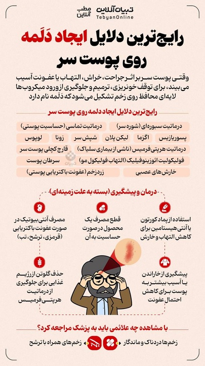 رایج ترین دلایل ایجاد دلمه روی پوست سر 