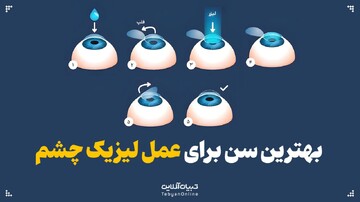 بهترین سن برای عمل لیزیک چشم
