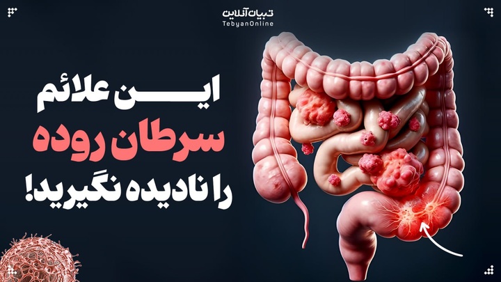 علائم سرطان روده که جوانان نباید نادیده بگیرند
