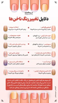 دلایل تغییررنگ ناخن‌ها