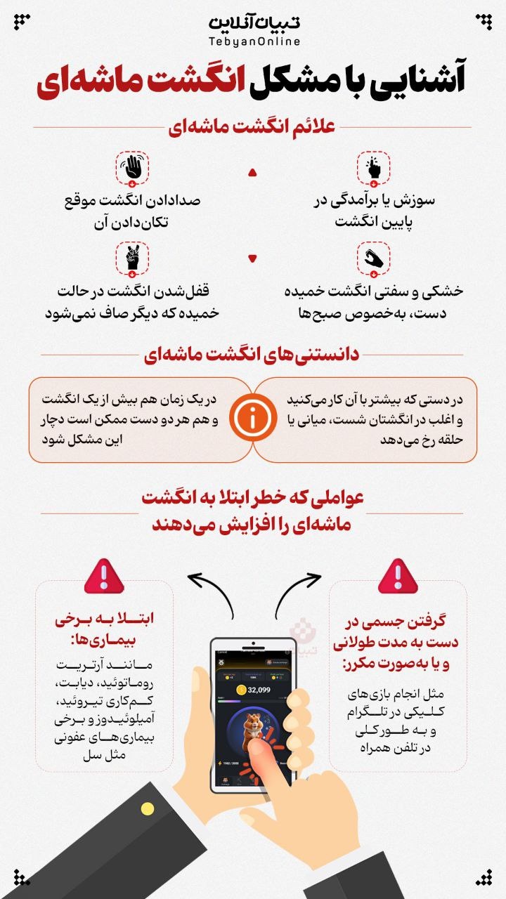 آشنایی با مشکل انگشت ماشهای آشنایی با مشکل انگشت ماشهای