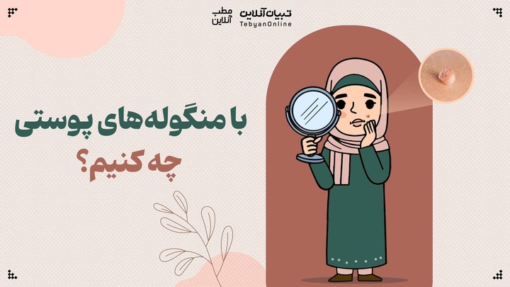 با منگوله‌های پوستی چه کنیم؟