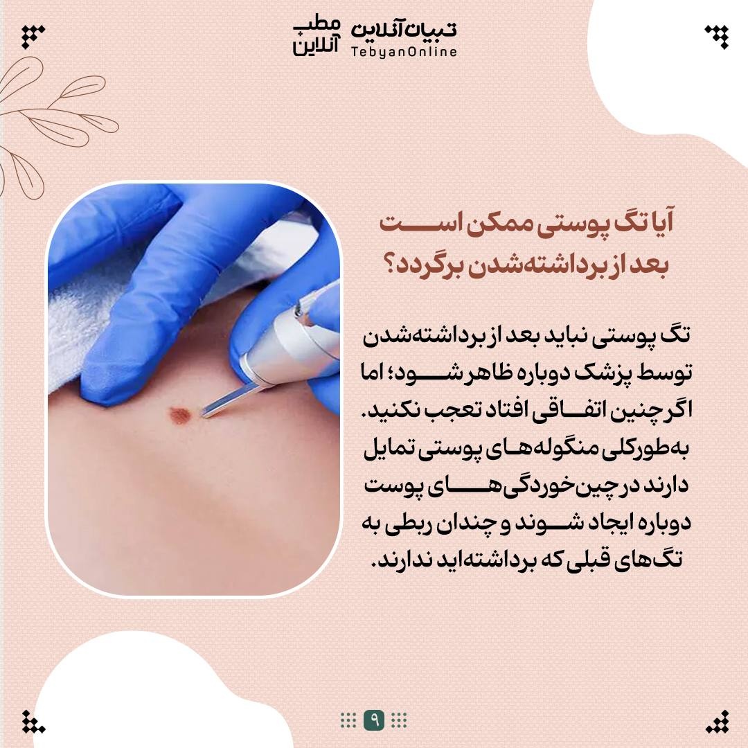 با منگولههای پوستی چه کنیم؟