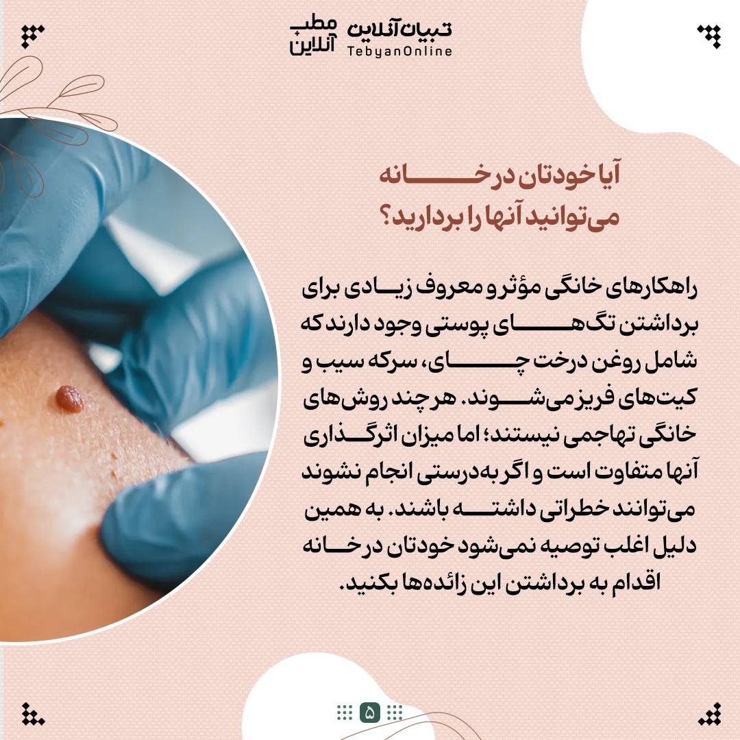 با منگوله‌های پوستی چه کنیم؟