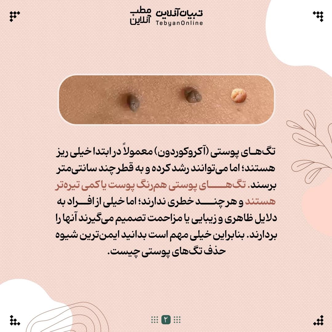با منگوله‌های پوستی چه کنیم؟
