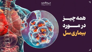 همه چیز در مورد بیماری سل
