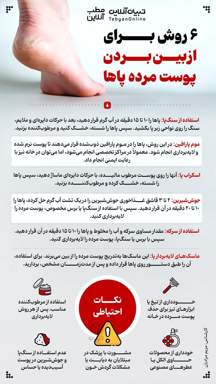۶ روش برای از بین بردن پوست مرده پاها ۶ روش برای از بین بردن پوست مرده پاها