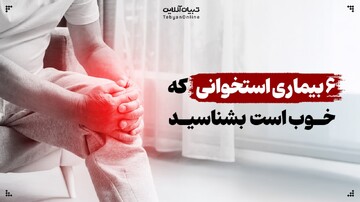 ۶ بیماری‌های استخوانی که باید بشناسید