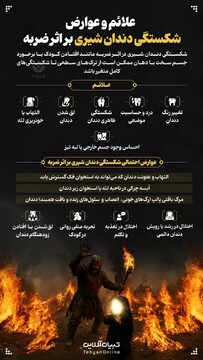 علائم و عوارض شکستگی دندان شیری بر اثر ضربه