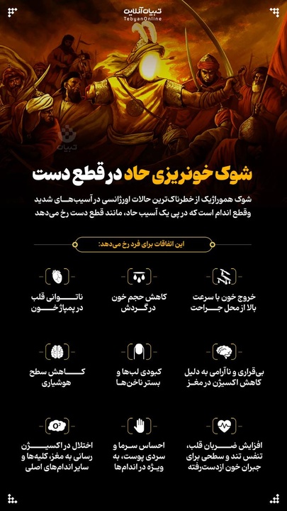شوک خونریزی حاد در قطع دست