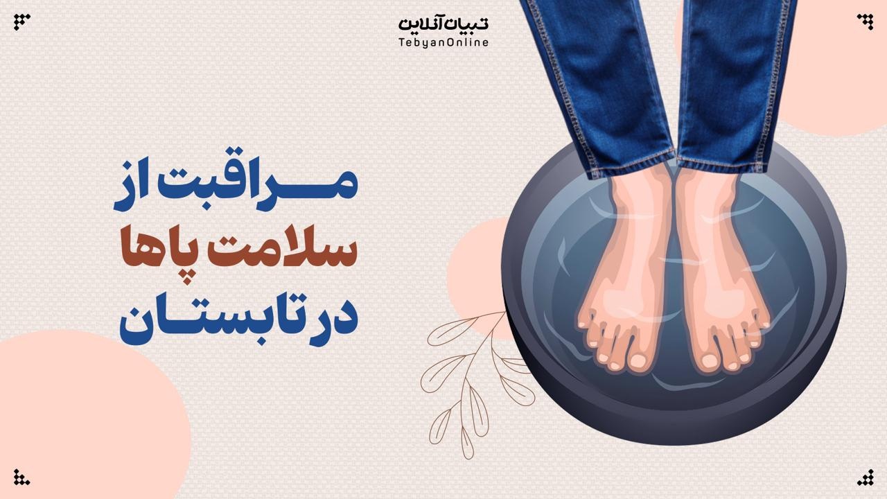 مراقبت از سلامت پاها در تابستان