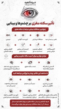 تاثیر سکته مغزی بر چشم‌ها و بینایی