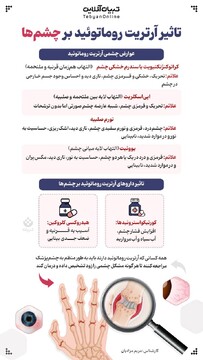 تاثیر آرتریت روماتوئید بر چشم‌ها