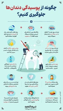 چگونه از پوسیدگی دندان جلوگیری کنیم؟