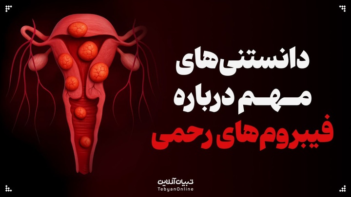 دانستنی‌های مهم درباره فیبروم‌های رحمی