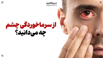 از سرماخوردگی چشم چه می‌دانید؟