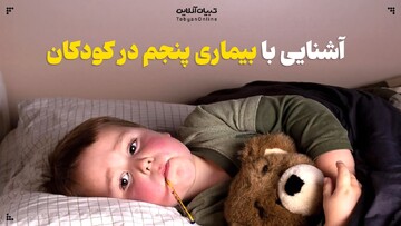 آشنایی با بیماری پنجم در کودکان