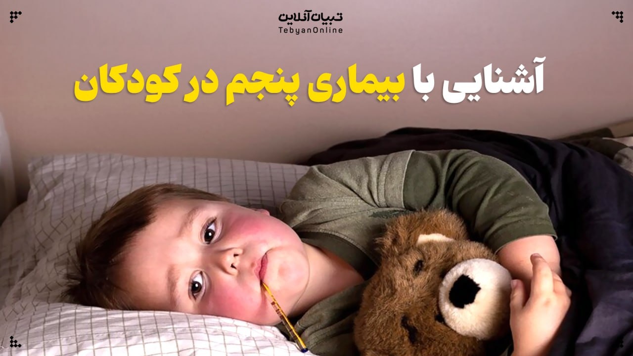 آشنایی با بیماری پنجم در کودکان