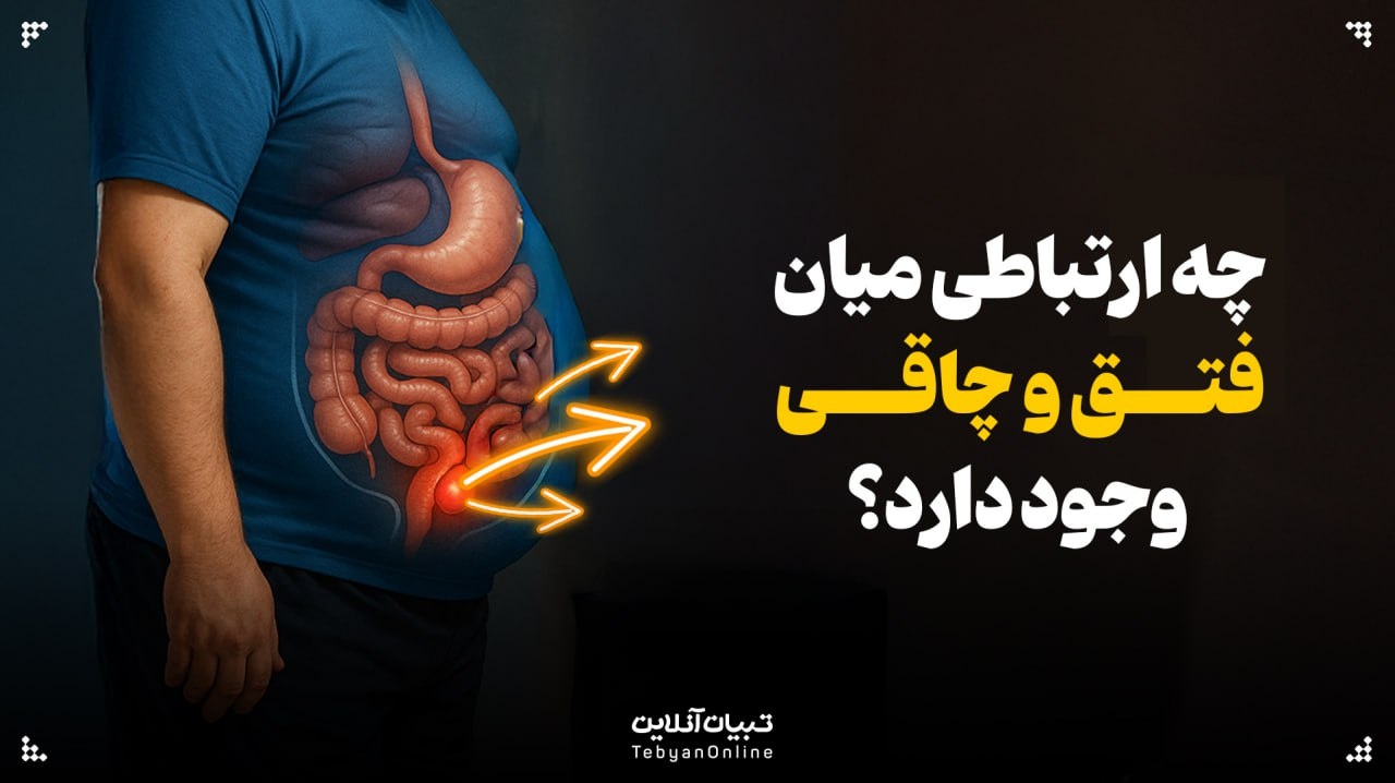 چه ارتباطی میان فتق و چاقی وجود دارد؟
