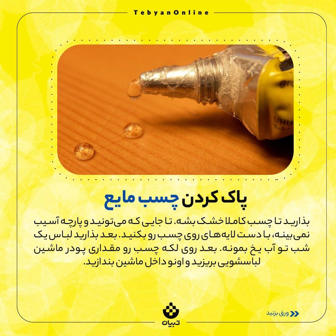 روش‌های پاک کردن چسب از روی لباس