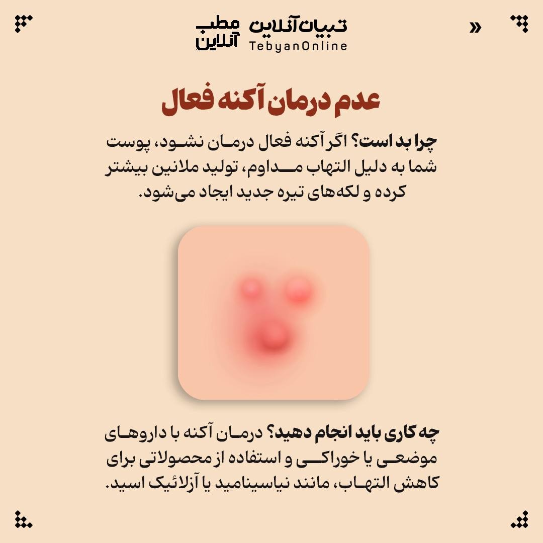 این ۷ اشتباه مراقبت پوستی رو انجام نده!