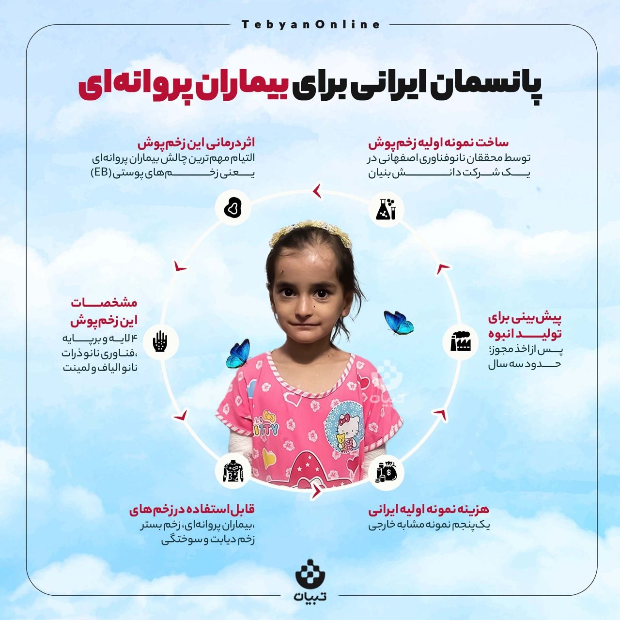 پانسمان ایرانی برای بیماران پروانه‌ای