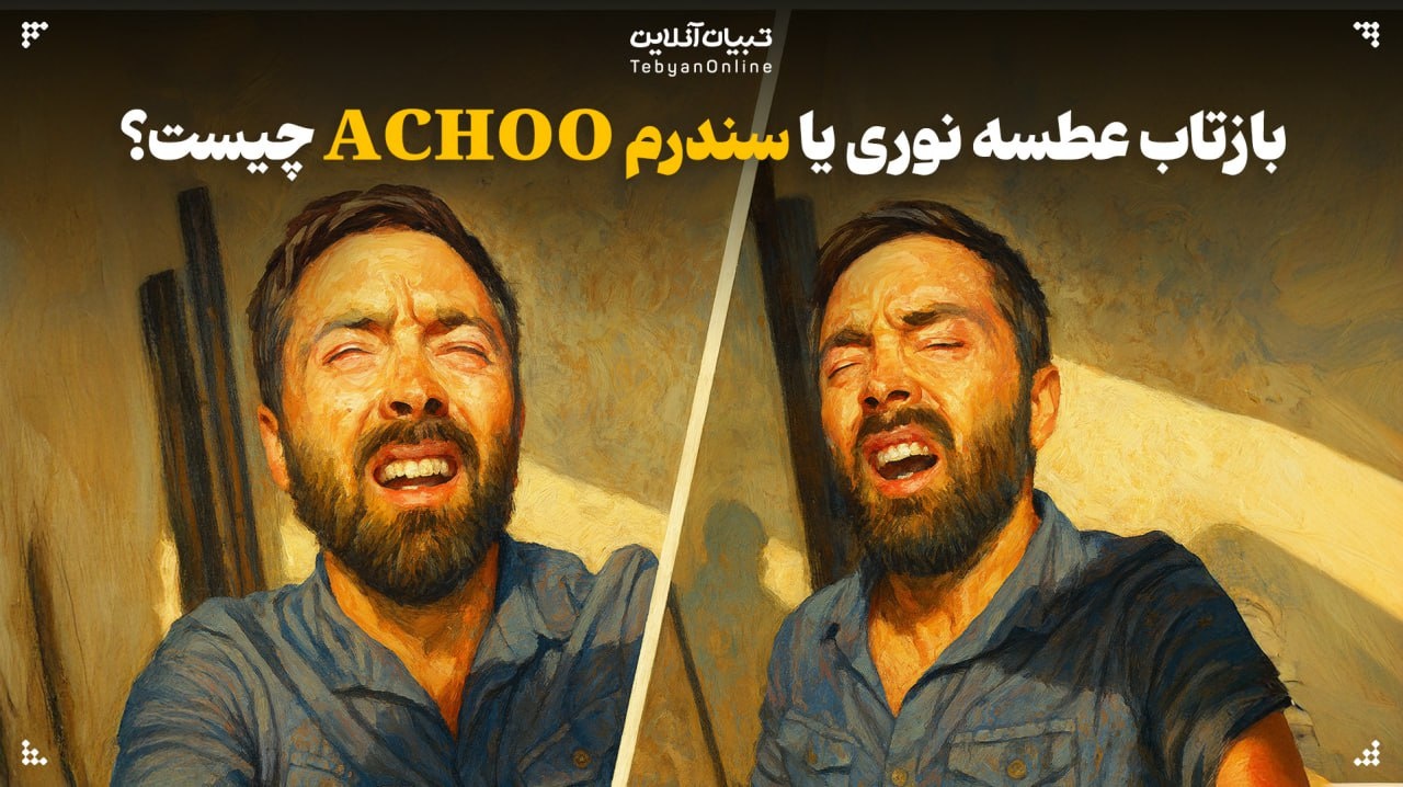 آشنایی با بازتاب عطسه نوری یا سندرم ACHOO