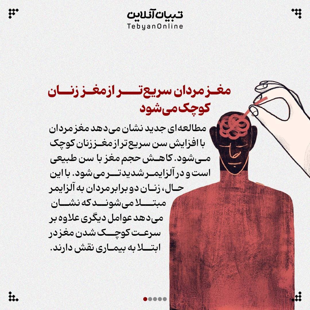 مغز مردان سریع‌تر پیر می‌شود!