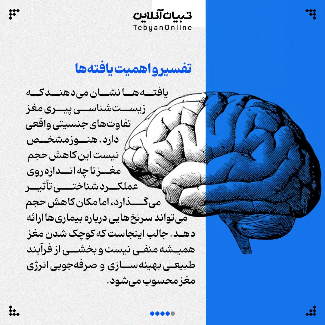 مغز مردان سریع‌تر پیر می‌شود!