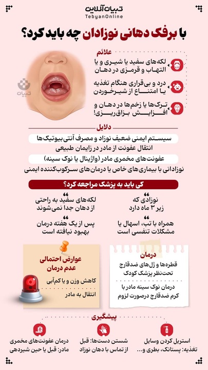راهنمای والدین برای برفک دهانی در نوزادان